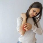 Researchers draw up a faster method of diagnosing skin allergies to medication Researchers draw up a faster method of diagnosing skin allergies to medication