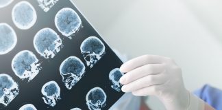 Cooling the brain may prevent or reduce trauma-induced seizures Cooling the brain may prevent or reduce trauma-induced seizures