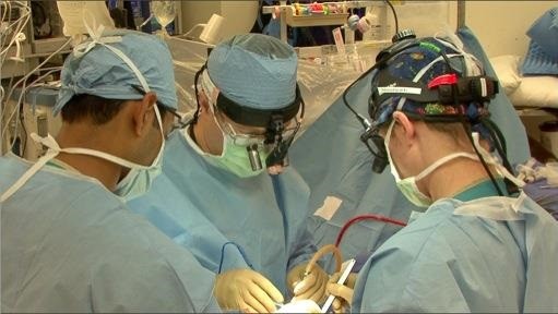 Epilepsy patients show improvement in wellbeing after surgery