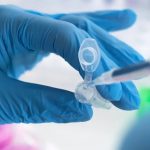 Recent discovery could revolutionize how doctors treat prostate cancer Recent discovery could revolutionize how doctors treat prostate cancer