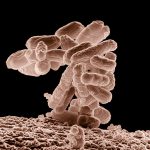 Controversy intensifies over fecal transplantation Controversy intensifies over fecal transplantation