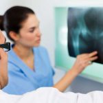 Osteoporosis screening inadequate for women aged 50-64 Osteoporosis screening inadequate for women aged 50-64