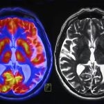 Next-generation antidepressants act on different brain chemical Next-generation antidepressants act on different brain chemical