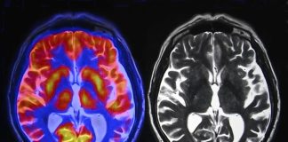 Next-generation antidepressants act on different brain chemical Next-generation antidepressants act on different brain chemical