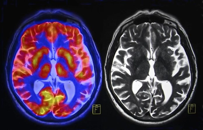 Next-generation antidepressants act on different brain chemical