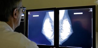 Does bilateral mastectomy for breast cancer increase survival? Does bilateral mastectomy for breast cancer increase survival?