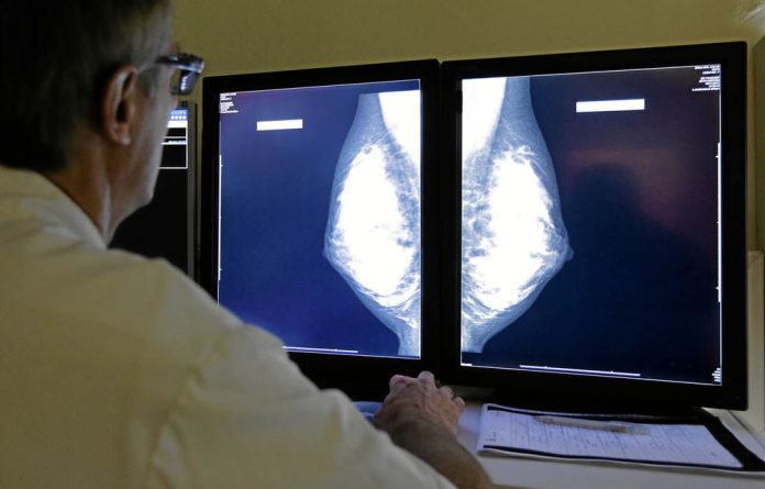 Does bilateral mastectomy for breast cancer increase survival?