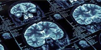 Poverty’s Lasting Effects on the Brain Poverty's Lasting Effects on the Brain