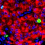 Stem cell study by Harvard and MIT is a breakthrough for diabetic patients Stem cell study by Harvard and MIT is a breakthrough for diabetic patients