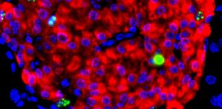 Stem cell study by Harvard and MIT is a breakthrough for diabetic patients Stem cell study by Harvard and MIT is a breakthrough for diabetic patients
