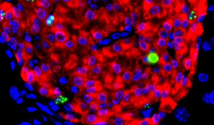 Stem cell study by Harvard and MIT is a breakthrough for diabetic patients
