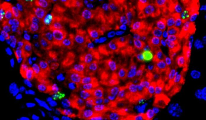 Stem cell study by Harvard and MIT is a breakthrough for diabetic patients
