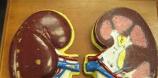 Folic acid supplements reduce first stroke risk among hypertensive adults Folic acid supplements reduce first stroke risk among hypertensive adults