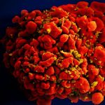 HIV accelerate development of age-related diseases HIV accelerate development of age-related diseases