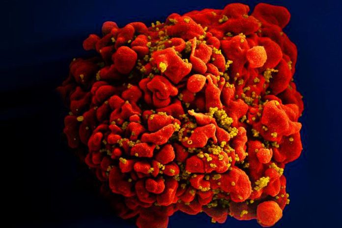 HIV accelerate development of age-related diseases