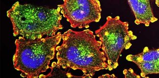 Triple whammy therapy combats deadly melanomas Triple whammy therapy combats deadly melanomas