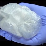 UCLA cardiologists print 3-D model of heart to prep for surgery UCLA cardiologists print 3-D model of heart to prep for surgery