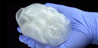 UCLA cardiologists print 3-D model of heart to prep for surgery UCLA cardiologists print 3-D model of heart to prep for surgery