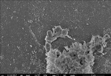 Bacterium discovered that destroys major pollutants Bacterium discovered that destroys major pollutants
