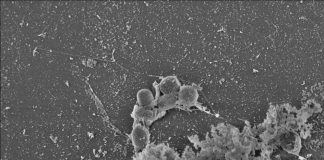 Bacterium discovered that destroys major pollutants Bacterium discovered that destroys major pollutants