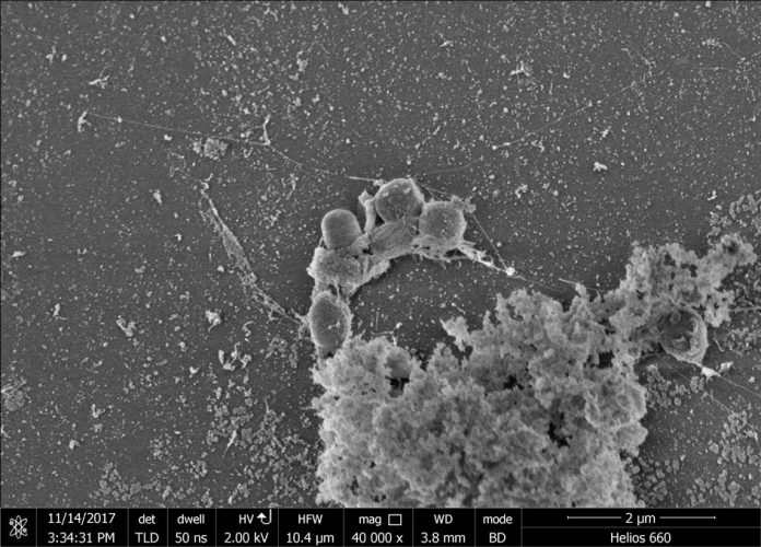 Bacterium discovered that destroys major pollutants