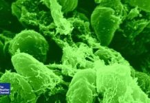 New study finds the plague to be at least 6,000 years old New study finds the plague to be at least 6,000 years old