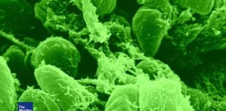 New study finds the plague to be at least 6,000 years old New study finds the plague to be at least 6,000 years old