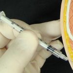 Subcutaneous fat role in infection defense discovered Subcutaneous fat role in infection defense discovered