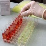 Using a Balance Test Can Predict Stroke Risk Using a Balance Test Can Predict Stroke Risk