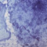 Researchers find a way to reverse antibiotic resistance in bacteria Researchers find a way to reverse antibiotic resistance in bacteria