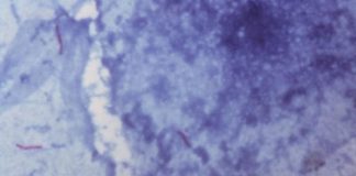 Researchers find a way to reverse antibiotic resistance in bacteria Researchers find a way to reverse antibiotic resistance in bacteria