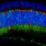 Ancient viruses resurrected to improve gene therapy Ancient viruses resurrected to improve gene therapy