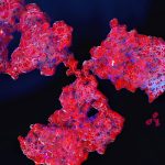 New study confirms throat bacteria link to schizophrenia New study confirms throat bacteria link to schizophrenia