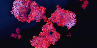 New study confirms throat bacteria link to schizophrenia New study confirms throat bacteria link to schizophrenia