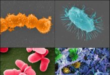 Urban Disinfectant Use Alters Microbial Ecosystems, Raising Health Concerns