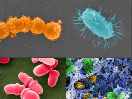 Urban Disinfectant Use Alters Microbial Ecosystems, Raising Health Concerns