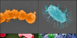 Urban Disinfectant Use Alters Microbial Ecosystems, Raising Health Concerns Urban Disinfectant Use Alters Microbial Ecosystems, Raising Health Concerns