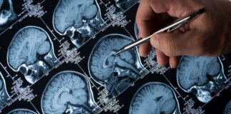 Lithium: The Unsung Mineral That Could Shield the Brain from Alzheimer’s Lithium: The Unsung Mineral That Could Shield the Brain from Alzheimer’s